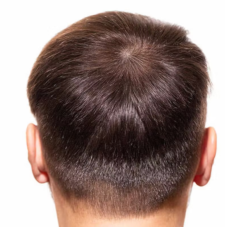 image comparison after